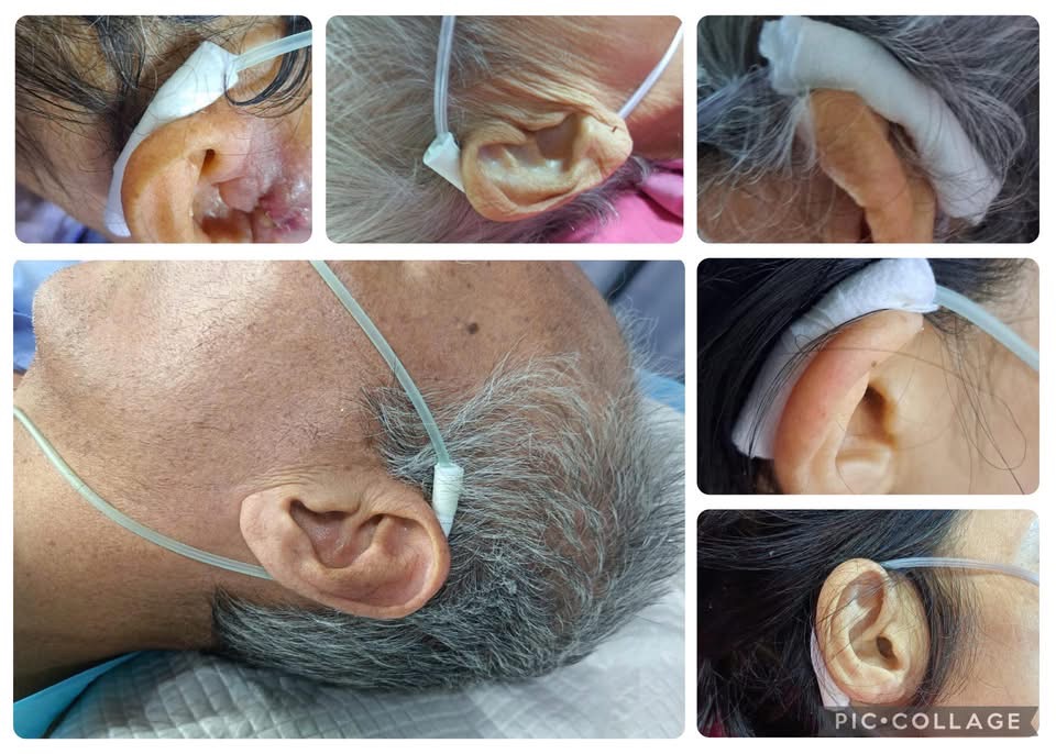 你家里也有人用着氧气吗？供你参考。。。